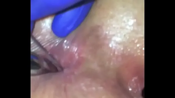 Hot Anal injections female totalt rør